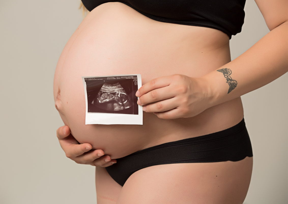 babybauchfoto, schwangerschaft foto, schwangerschaftshooting, babybauch